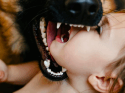 #Hund Kind Attacke Hundeangriff go
