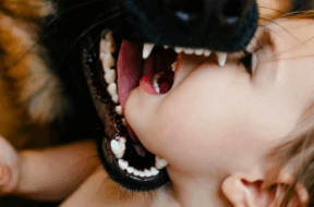 #Hund Kind Attacke Hundeangriff go