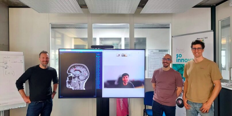 Künstliche Intelligenz unterstützt Diagnose und Behandlung von Multipler SkleroseHirnläsionen erkennen und richtig einordnen